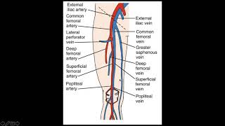 Deep Venous Thrombosis Ultrasound JETem 2017 [upl. by Ijok]