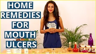 3 Best HOME REMEDIES FOR MOUTH ULCERS TREATMENT [upl. by Cela610]