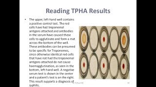 TPHA TestPositive [upl. by Dorri]