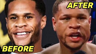 Devin Haney BEFORE amp AFTER getting BUSTED UP amp BEATEN by Ryan Garcia [upl. by Rider649]