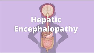 Cirrhosis – Hepatic encephalopathy [upl. by Changaris]