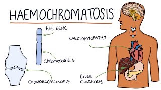 Understanding Haemochromatosis [upl. by Eenad]