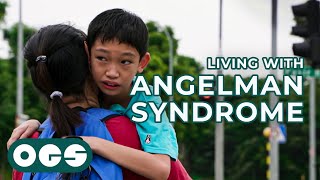 Living with Epilepsy and Angelman Syndrome [upl. by Inig]