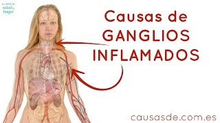 Causas de ganglios inflamados [upl. by Iilek]