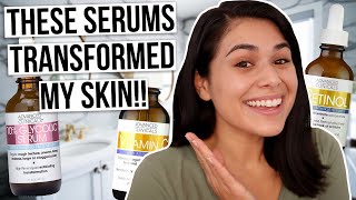 3 BEST Serums for Acne and Hyperpigmentation UNDER 16 [upl. by Adon]