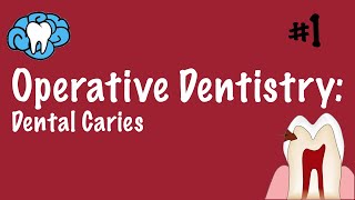 Operative Dentistry  Dental Caries  INBDE ADAT [upl. by Ydnamron638]