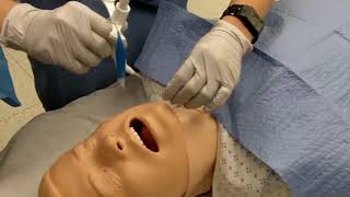 What is Tracheostomy [upl. by Acinorej295]