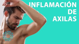 CAUSAS de las AXILAS INFLAMADAS [upl. by Akcemat]