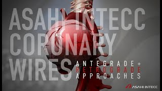 Antegrade  Retrograde Approach Asahi Intecc [upl. by Ofella]