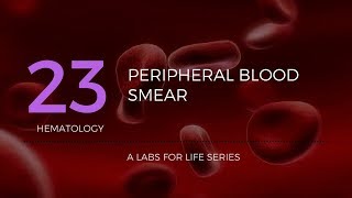 Part 1  Preparation of Peripheral Blood Smear PBS [upl. by Nanaj997]