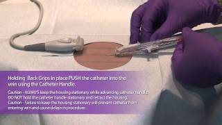 HOW TO ACCESS A PORTACATH IMPLANTED PORT [upl. by Eilla]