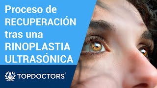 RECUPERACIÓN tras una RINOPLASTIA ULTRASÓNICA  Dr Fresnillo Cuesta  Top Doctors Parte 34 [upl. by Lamak]