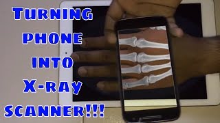 Xray Scan App Free for Android Prank App [upl. by Lydie]