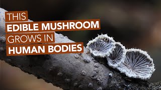 This Edible Mushroom Grows In Human Bodies [upl. by Irab]