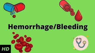 Hemorrhage bleeding Causes Signs and Symptoms Diagnosis and Treatment [upl. by Yelyac682]