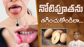 How to Get Rid of Mouth Ulcers  Diet Plan to Relief from Canker Sore  Dr Manthenas Health Tips [upl. by Paten878]