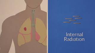 Cancer treatment what happens during radiotherapy  NHS [upl. by Onitnelav73]