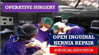 How do we get inguinal hernias [upl. by Adamina]