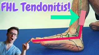 Flexor Hallucis Longus PAIN FHL Tendonitis BEST Treatment [upl. by Yuri]