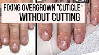 How to FIX Overgrown Cuticles WITHOUT CUTTING [upl. by Nilloc]