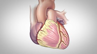 Atrioventricular Blocks AV Blocks  EKG Interpretation  LevelUpRN [upl. by Inafetse216]