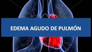 Edema agudo de pulmón  Fisiopatología [upl. by Bopp584]