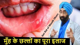 Cure Mouth Ulcers  Best Home remedy amp Medical treatment Explained  DrEducation [upl. by Eyahc]