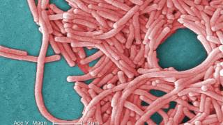 Legionnaires Disease What You Need to Know [upl. by Heise111]