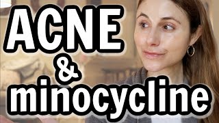 Minocycline versus doxycycline for acne Dr Dray [upl. by Nagyam]