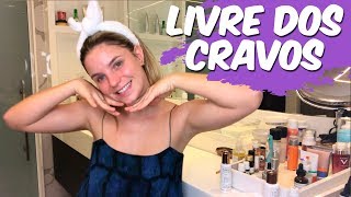 COMO ACABAR COM OS CRAVOS  SKINCARE PARA CRAVOS [upl. by Attena]