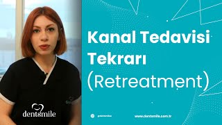 Kanal tedavisi tekrarı retreatment [upl. by Jermyn]