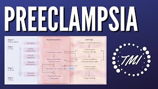 Preeclampsia Explicada Claramente [upl. by Attalanta84]