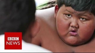 My 10yearold son weighs 188kg  BBC News [upl. by Adi]