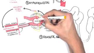 Chronic Kidney Disease CKD Pathophysiology [upl. by Alol]