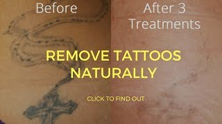 How To Remove Tattoos Naturally [upl. by Ellehcer65]