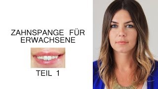 Zahnspange für Erwachsene  Der erste Schritt [upl. by Inness]