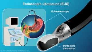 Understanding EUSFNA [upl. by Nyrahtak]