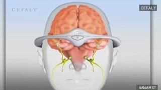 This headband could prevent your migraines [upl. by Nnad]