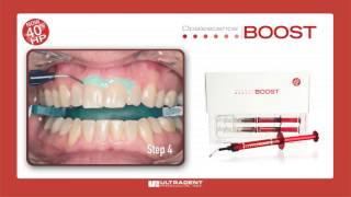 Ultradent Opalescence Boost Whitening [upl. by Marylinda]