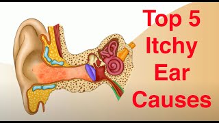 Top 5 Causes of Itchy Ears and Treatment Too [upl. by Patience]