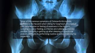 Exercise for Osteoporosis Osteopenia amp Strong Bones [upl. by Ymmaj]