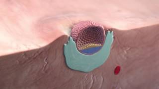 Implantation of the blastocyst [upl. by Starkey]