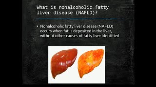 Fatty Liver The Silent Epidemic [upl. by Silisav]