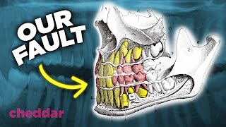 The Surprising Reason Why Human Teeth Are A Design Disaster  Cheddar Explains [upl. by Aicnetroh]