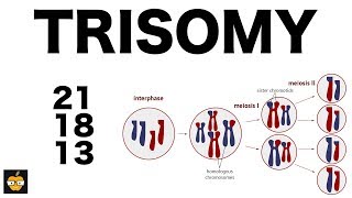 Trisomy 21 18 and 13 amp Nondisjunction Genetics [upl. by Hadria]