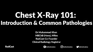 RadCast Academy Introduction To The Chest XRay amp Common Pathologies cxr radcast [upl. by Ladnyk]