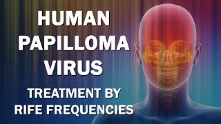 Treatment of vocal cord papilloma [upl. by Frank520]