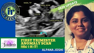 FIRST TRIMESTER ANOMALY SCAN  How I do it by Alpana Joshi  FETAL IMAGING  NASAL BONE amp NT [upl. by Hammad]