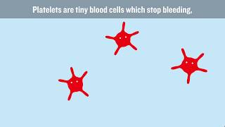 What causes DVT and how can we stop it [upl. by Atiran]