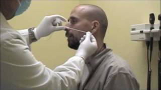 Procedure for Nasopharyngeal Swabs and Aspirates [upl. by Narmi]